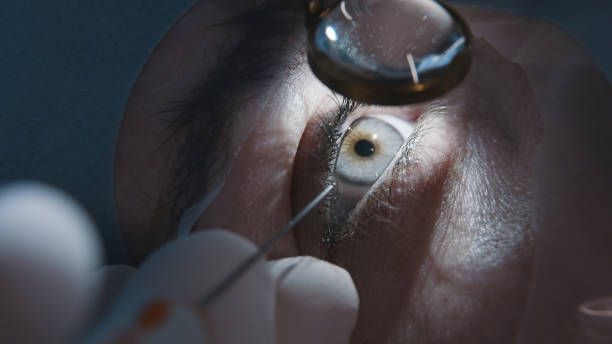 How Reconstructive Eye Procedures Improve Daily Confidence